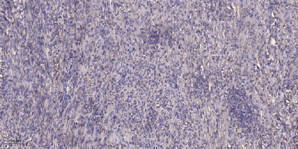 a06178 1 stard13 primary antibodies ihc testing 2