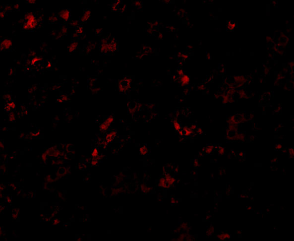 a06179 1 ap2m1 primary antibodies if testing 3