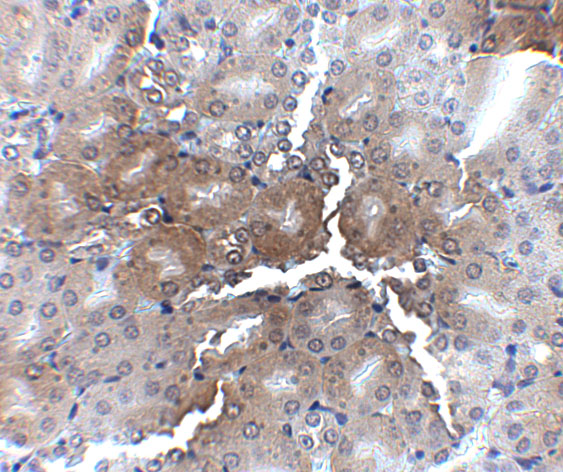 a06179 1 ap2m1 primary antibodies ihc testing 2