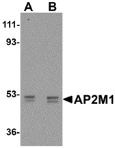 a06179 1 ap2m1 primary antibodies wb testing 1