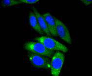 ICC staining AP2M1 in HepG2 cells (green)