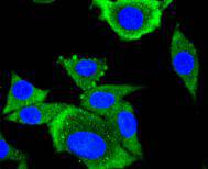 ICC staining AP2M1 in SH-SY-5Y cells (green)