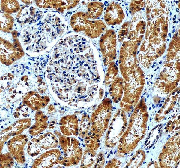 IHC analysis of AP2M1 using anti-AP2M1 antibody (A06179-3)