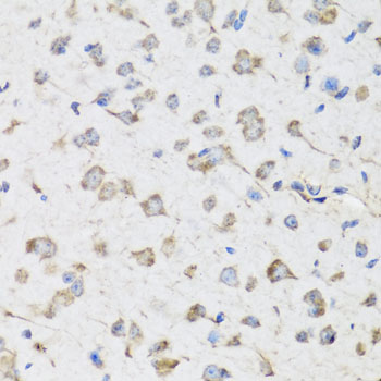 a06182 2 usp25 primary antiboties ihc testing 3