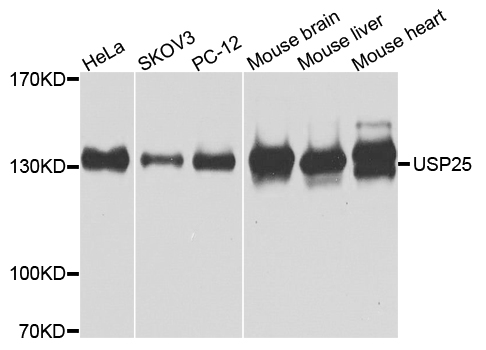 a06182 2 usp25 primary antiboties wb testing 1