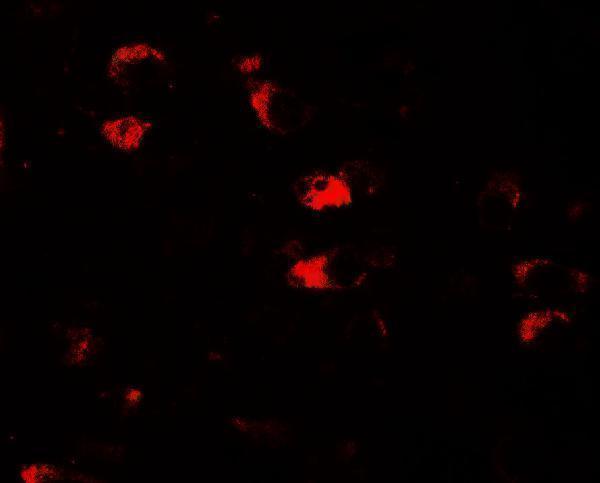 a06182 usp25 primary antibodies if testing 3