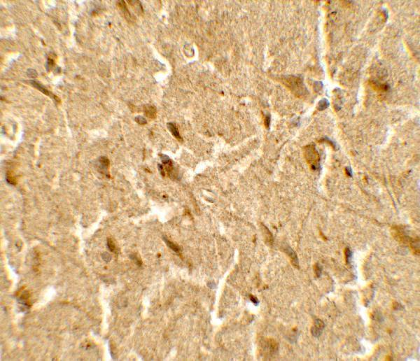 a06182 usp25 primary antibodies ihc testing 2