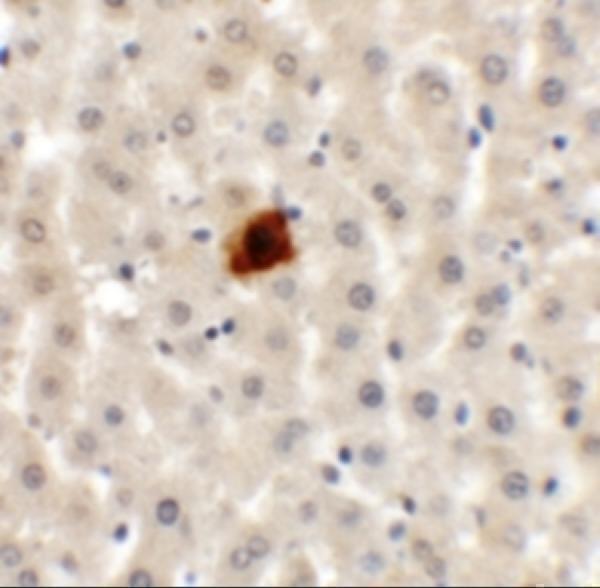 a06183 ei24 primary antibodies ihc testing 2