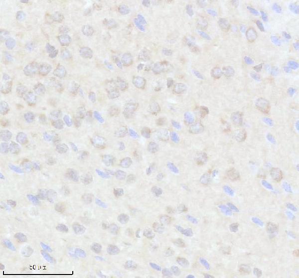 a06185 1 evi5 primary antibodies ihc testing 1