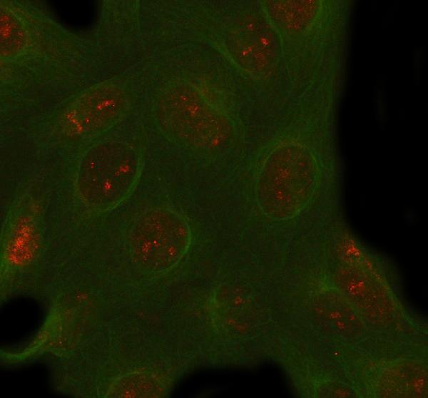 a06188 2 pacsin1 primary antibodies if testing 8
