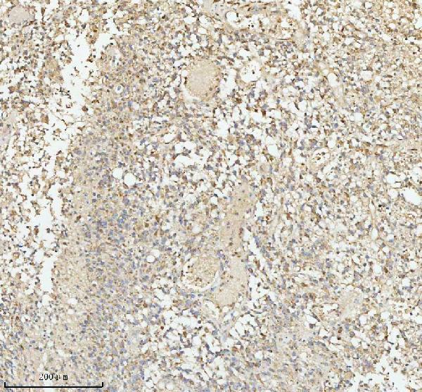  IHC analysis of PACSIN1 using anti-PACSIN1 antibody (A06188-2)