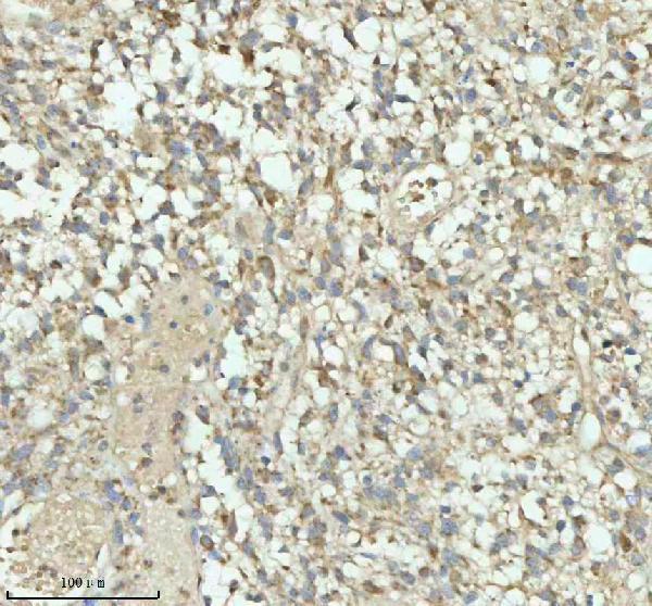  IHC analysis of PACSIN1 using anti-PACSIN1 antibody (A06188-2)