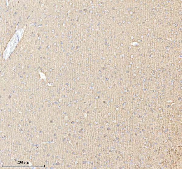 a06188 2 pacsin1 primary antibodies ihc testing 4