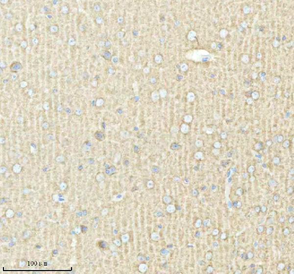 a06188 2 pacsin1 primary antibodies ihc testing 5