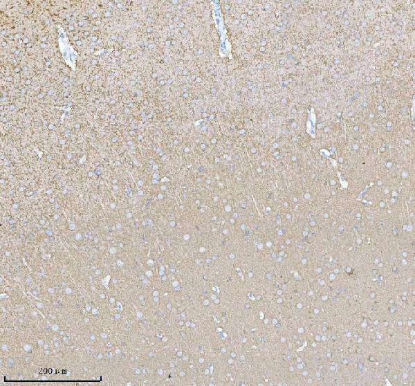 a06188 2 pacsin1 primary antibodies ihc testing 6