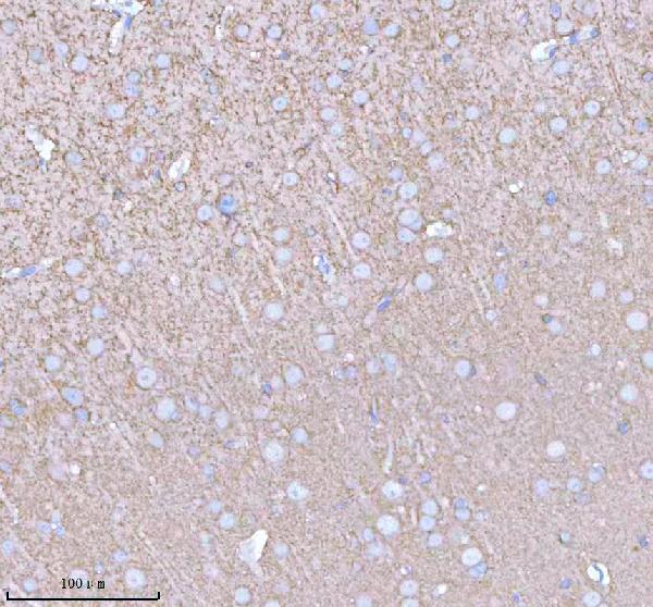 a06188 2 pacsin1 primary antibodies ihc testing 7