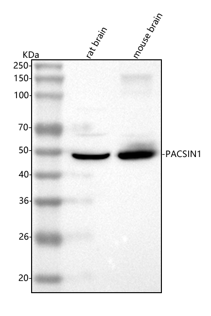  Western blot analysis of PACSIN1 using anti-PACSIN1 antibody (A06188-2)