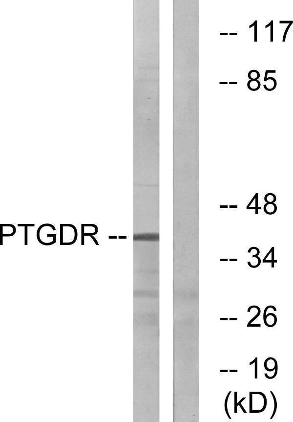 Western blot analysis of lysates from HepG2 cells, using PTGDR Antibody