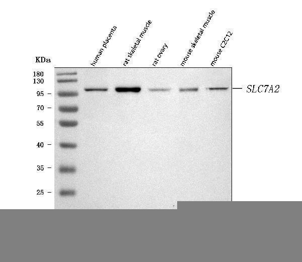 a06193 1 slc7a2 primary antibodies wb testing 1