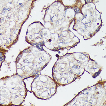 Immunohistochemistry of paraffin-embedded human placenta using SLC7A2 antibody  at dilution of 1:100 