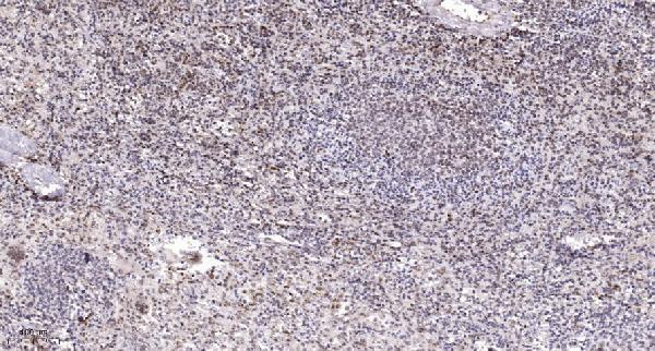 a06194 1 elavl2 primary antibodies ihc testing 4