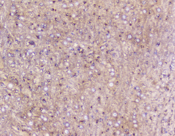 a06194 2 elavl2 hub primary antibodies ihc testing 2