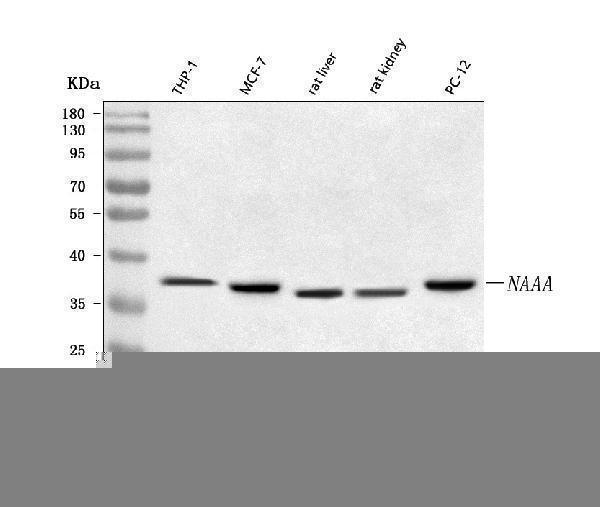  Western blot analysis of NAAA using anti-NAAA antibody (A06195-1)