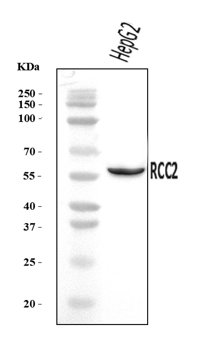  Western blot analysis of RCC2 using anti-RCC2 antibody (A06203-2)