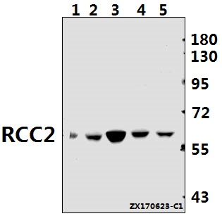 a06203 rcc2 primary antiboties wb testing 1