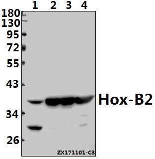 Western blot (WB) analysis of Hox-B2 (P67) pAb at 1:1000 dilution
Lane1:K562 whole cell lysate(40ug)
Lane2:The Embryo tissue lysate of Mouse(20ug)
Lane3:PC12 whole cell lysate(10ug)
Lane4:Hela whole cell lysate(40ug)