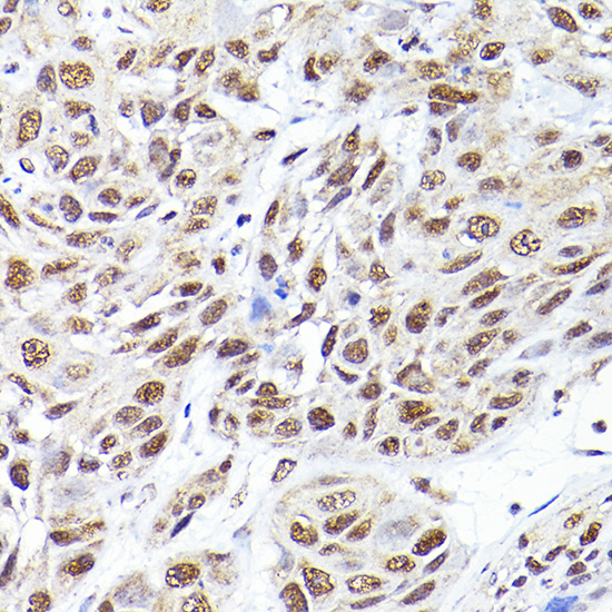 a06211 sec14l2 primary antiboties ihc testing 2