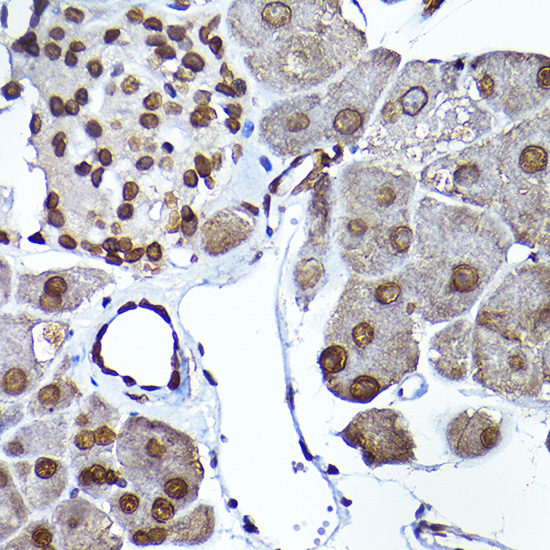a06211 sec14l2 primary antiboties ihc testing 3