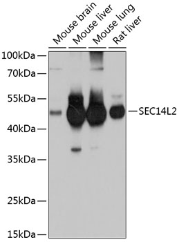a06211 sec14l2 primary antiboties wb testing 1