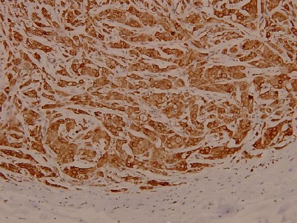 a06212 1 eif3d primary antiboties ihc testing 2