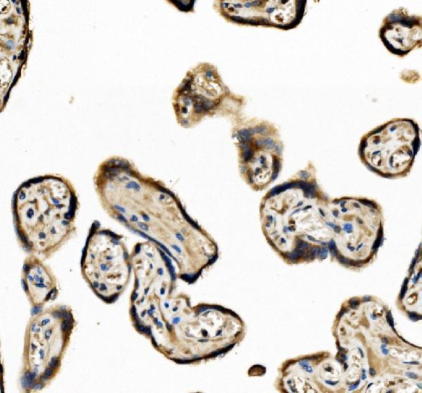 a06212 2 eif3d primary antibodies ihc testing 1