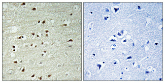 Immunohistochemistry validation of POLR3B using Anti-POLR3B Antibody (A06213)