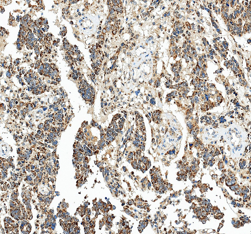 IHC analysis of ENOX2 using anti-ENOX2 antibody (A06214-2)