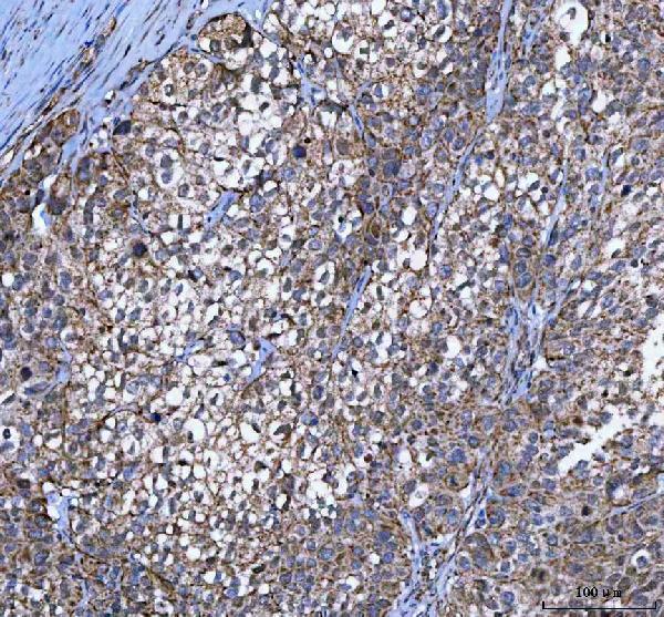  IHC analysis of MYCBP using anti-MYCBP antibody (A06216-2)