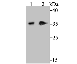 Western blot analysis of Syntaxin 3 on SH-SY-5Y cell (1) and human kidney tissue (2) lysate using anti-Syntaxin 3 antibody at 1/1,000 dilution