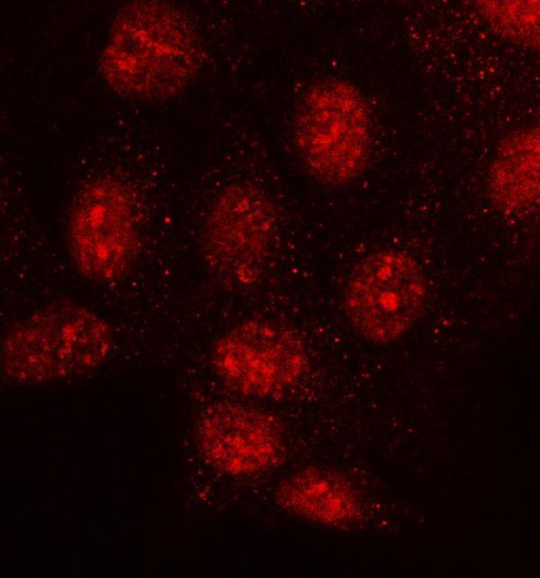 a06218 2 mms19 primary antibodies if testing 5