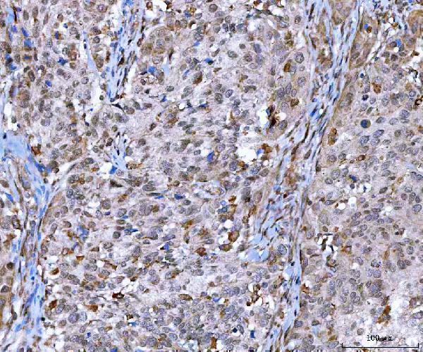 a06218 2 mms19 primary antibodies ihc testing 2