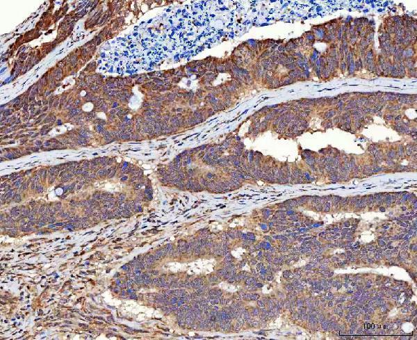 a06218 2 mms19 primary antibodies ihc testing 3