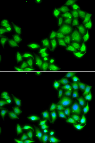 Immunofluorescence analysis of A549 cell using OGFR antibody