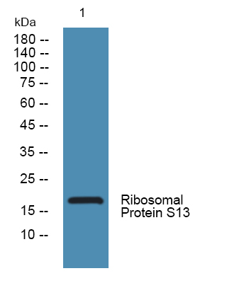 Western blot analysis of lysates from PC12 cells, primary antibody was diluted at 1:1000, 4°over night