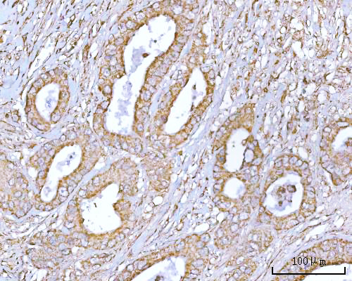  IHC analysis of RPS13 using anti-RPS13 antibody (A06221-3)