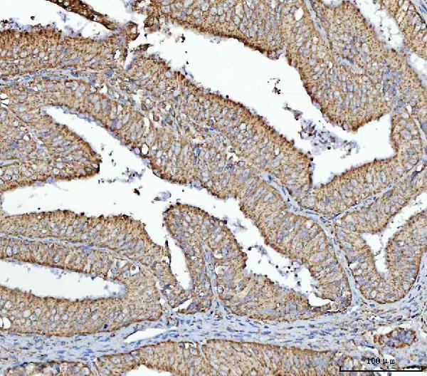  IHC analysis of RPS13 using anti-RPS13 antibody (A06221-3)