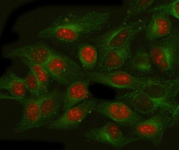 a06226 2 nat10 primary antibodies if testing 2