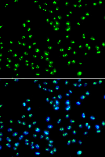 a06226 nat10 primary antiboties if testing 2