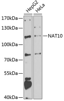 a06226 nat10 primary antiboties wb testing 1