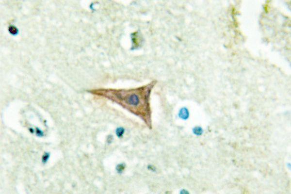 a06229 efna5 primary antiboties ihc testing 2